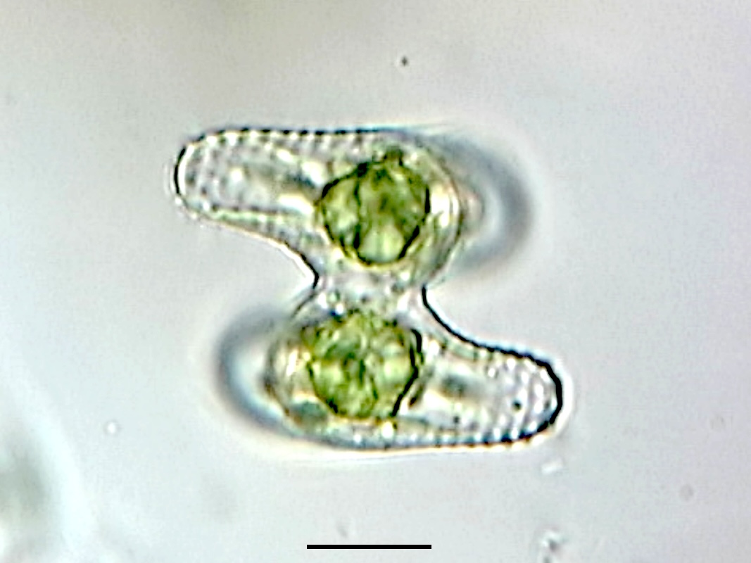Cosmarium crenatoides